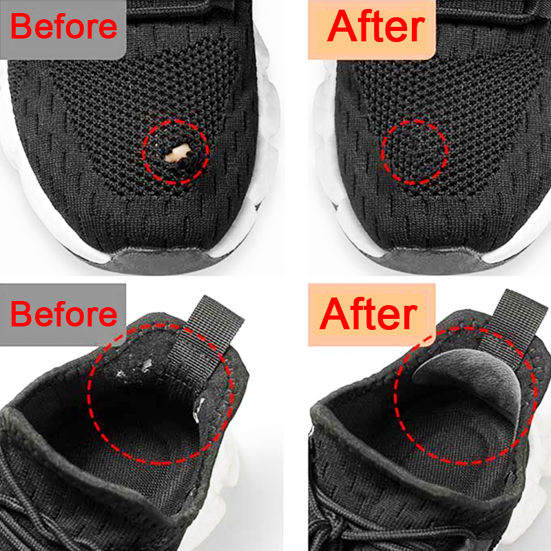 Патчи для спортивной обуви, ре – обзор и цена Sneaker Shoe Care Kit